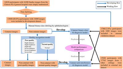 Artificial Intelligence Model for Antiinterference Cataract Automatic Diagnosis: A Diagnostic Accuracy Study